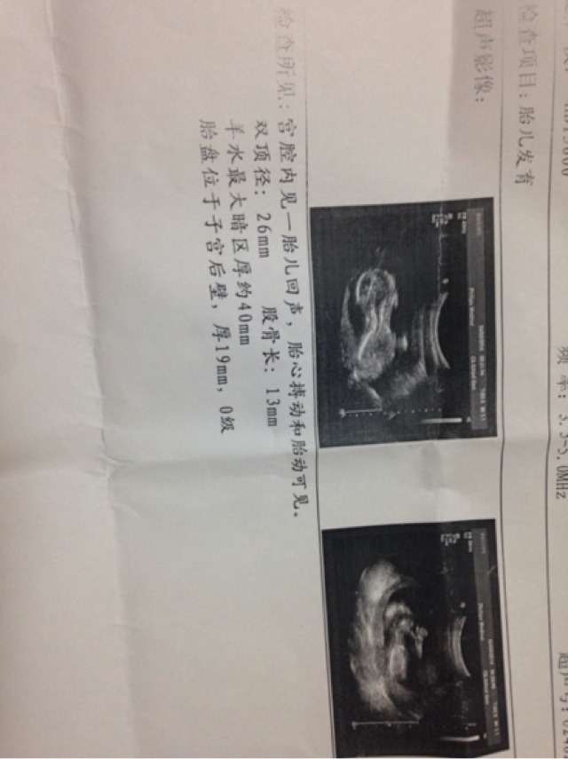 AG亚娱集团|广东省结核病各项防控指标均走在全国前列(图1) AG亚娱集团